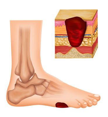 طلاب يقدمون إذاعة مدرسية عن التوعية الصحية بمرض السكري في فناء المدرسة